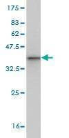 Anti-ROPN1 Antibody