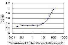 Anti-ROPN1 Antibody
