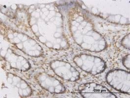 Anti-ROPN1 Antibody