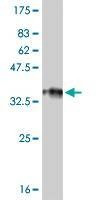 Anti-RP6-213H19.1 Antibody
