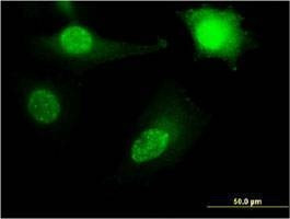Anti-RPL11 Antibody