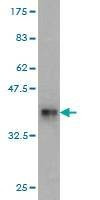 Anti-RPL18 Antibody