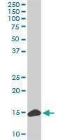 Anti-RPL36A Antibody