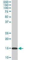 Anti-RPL36A Antibody