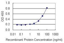 Anti-RPLP1 Antibody