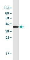 Anti-RPLP1 Antibody