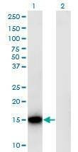 Anti-RPLP1 Antibody