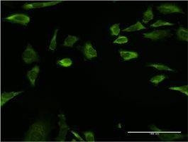 Anti-RPLP1 Antibody