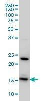 Anti-RPS17 Antibody