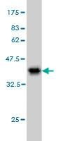 Anti-RPS2 Antibody