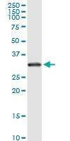 Anti-RPS2 Antibody