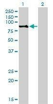 Anti-RPS6KA2 Antibody