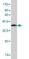 Anti-RPS6KA2 Antibody