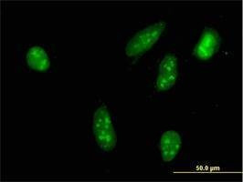 Anti-RPS6KA2 Antibody