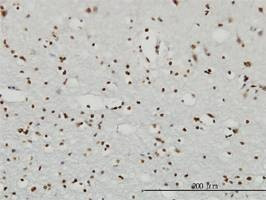 Anti-RPS6KA2 Antibody