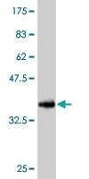 Anti-RPS6KA6 Antibody