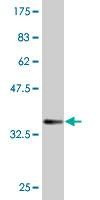 Anti-RRM2B Antibody