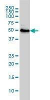 Anti-RRP9 Antibody