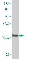 Anti-RUNX2 Antibody