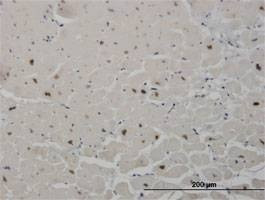Anti-SALL2 Antibody