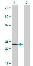 Anti-SALL2 Antibody