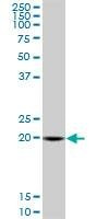 Anti-SAR1A Antibody