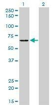 Anti-SARS Antibody