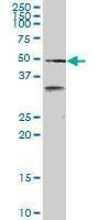 Anti-SCARA3 Antibody