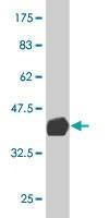 Anti-SCMH1 Antibody