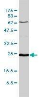 Anti-SDF2 Antibody