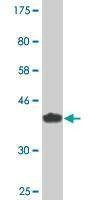 Anti-ABCC8 Antibody