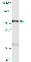 Anti-SEMA6B Antibody