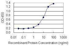 Anti-SEMA6B Antibody