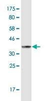 Anti-SEMA7A Antibody