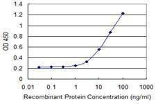 Anti-SEPHS1 Antibody