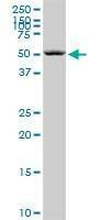 Anti-SEPT6 Antibody