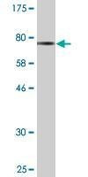 Anti-SEPT6 Antibody