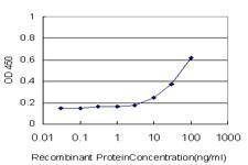 Anti-SERPINA6 Antibody