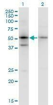 Anti-SERPINB1 Antibody