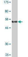 Anti-SERTAD1 Antibody