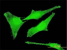 Anti-SET Antibody