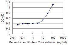 Anti-ABCF1 Antibody