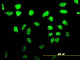Anti-SFRS17A Antibody
