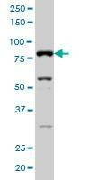 Anti-SFRS17A Antibody