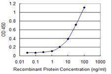 Anti-SFTPC Antibody