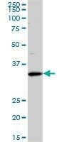 Anti-SFXN3 Antibody