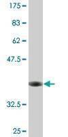 Anti-SFXN3 Antibody