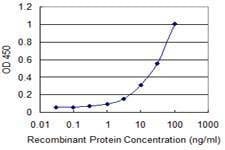 Anti-SFXN3 Antibody