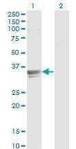Anti-SFXN3 Antibody