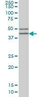Anti-SGCB Antibody